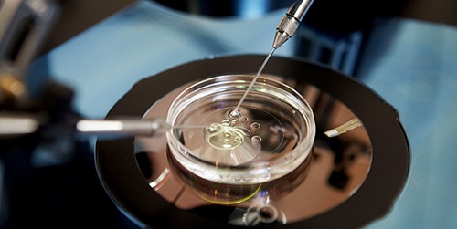 Our service - Best IVF Centre in Noida