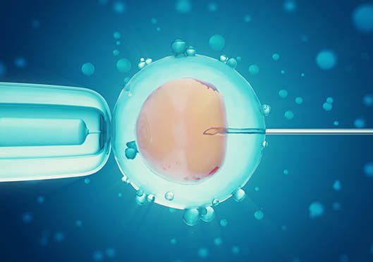 Intracytoplasmic Sperm Injection