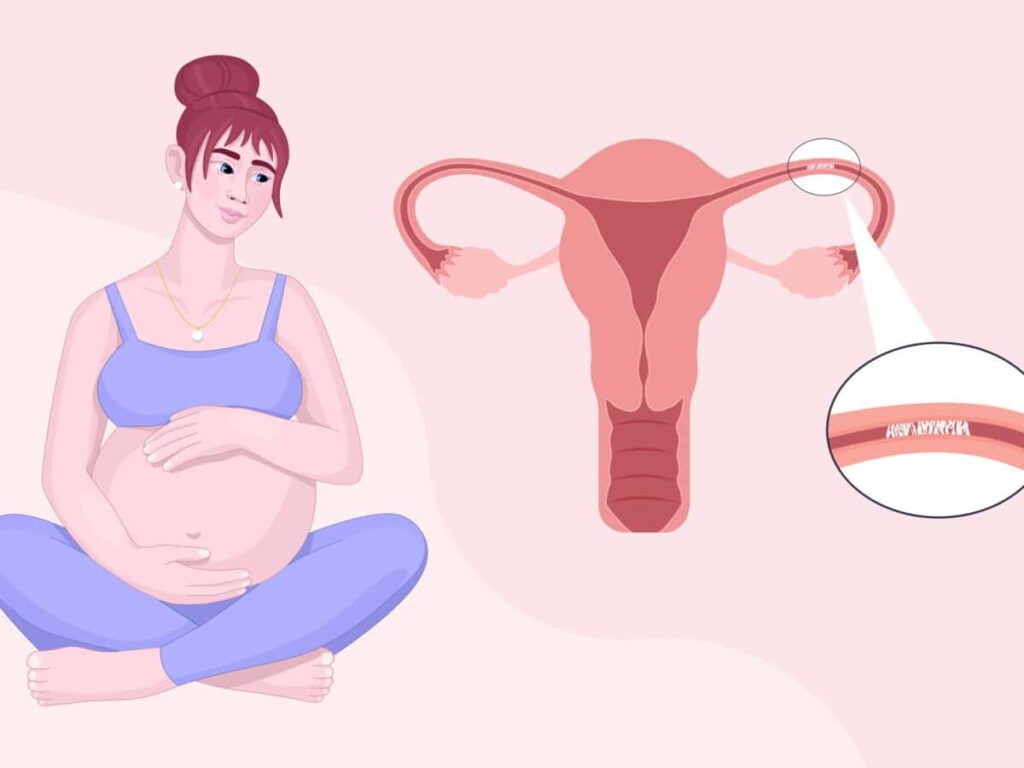 7 steps to getting pregnant with blocked fallopian tubes