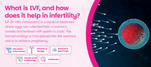 What is IVF
