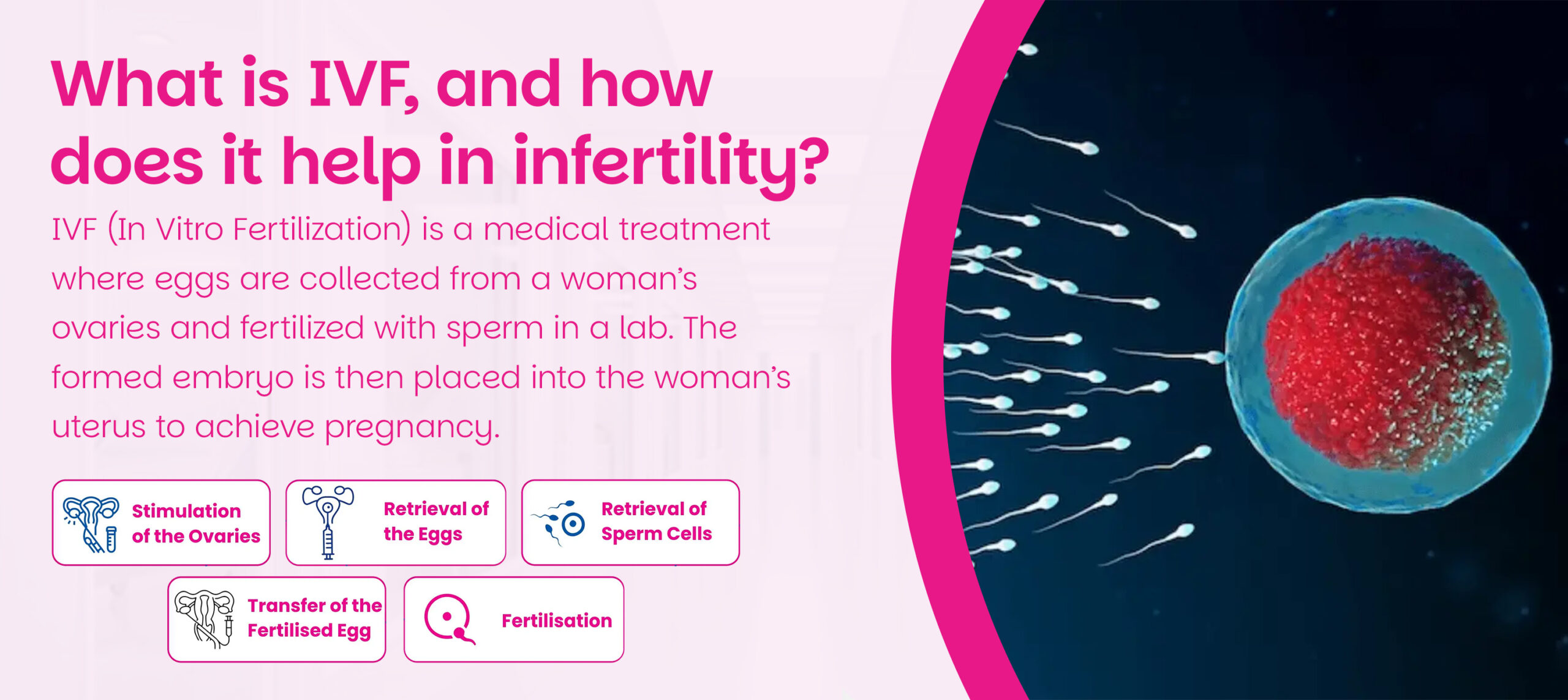 Read more about the article What is IVF, and how does it help in infertility?