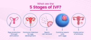 5 Stages of IVF treatment explained – egg stimulation, hormone injection, sperm retrieval, fertilization, and embryo implantation at Vrinda Fertility