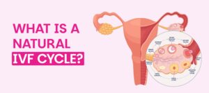 Natural IVF Cycle process illustration showing female reproductive system, ovarian follicles, egg development, and drug-free IVF treatment for infertility.