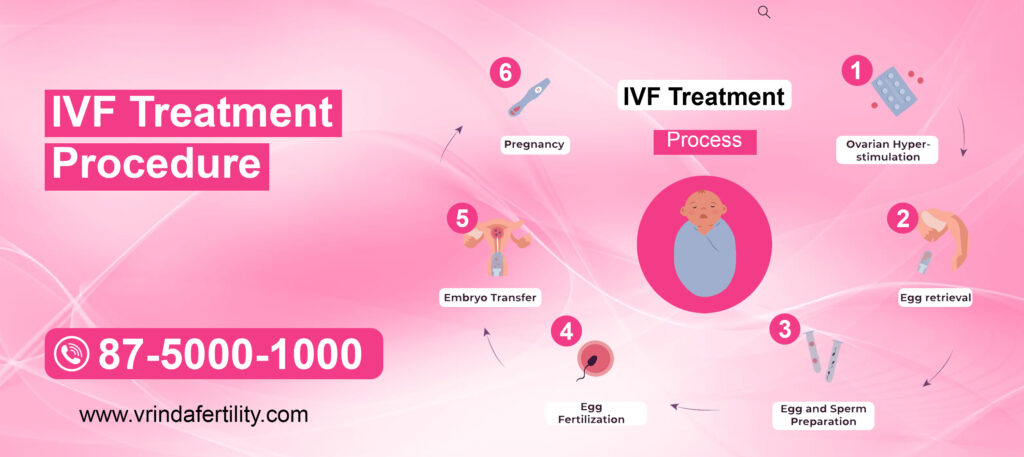IVF Treatment procedure