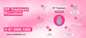 IVF Treatment procedure