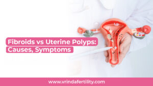 fibroids vs uterine polyps